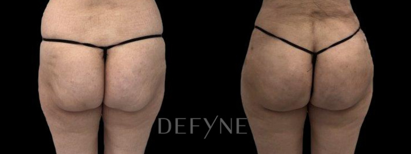 Patient #106886 Combined Image