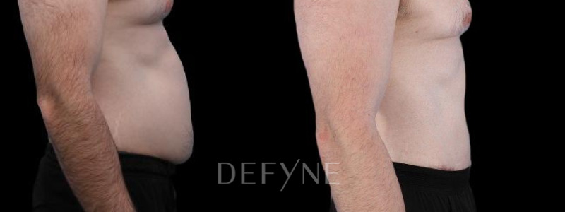 Patient #77187 Combined Image