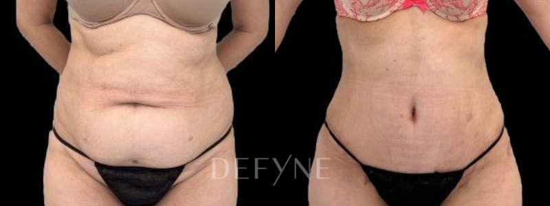 Patient #60014 Combined Image