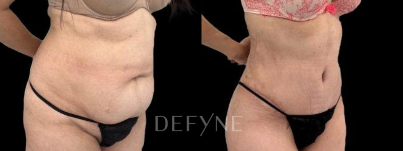 Patient #60014 Combined Image