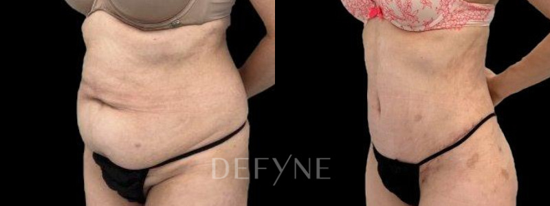 Patient #60014 Combined Image