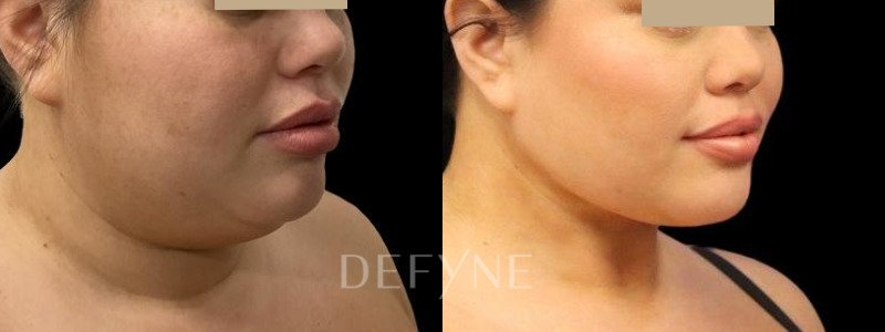 Patient #104895 Combined Image