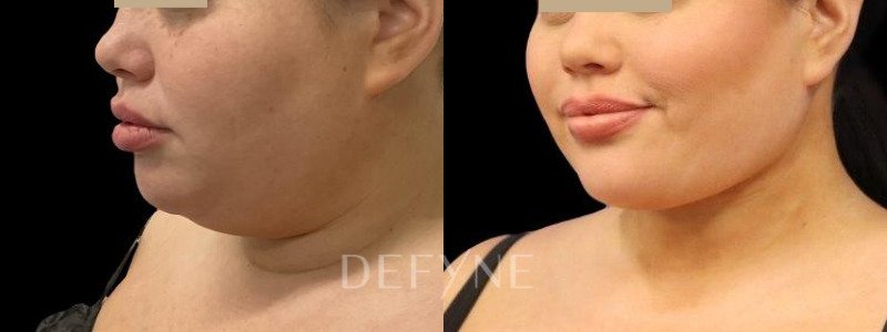 Patient #104895 Combined Image