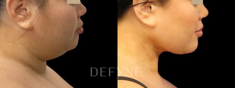 Patient #104895 Combined Image