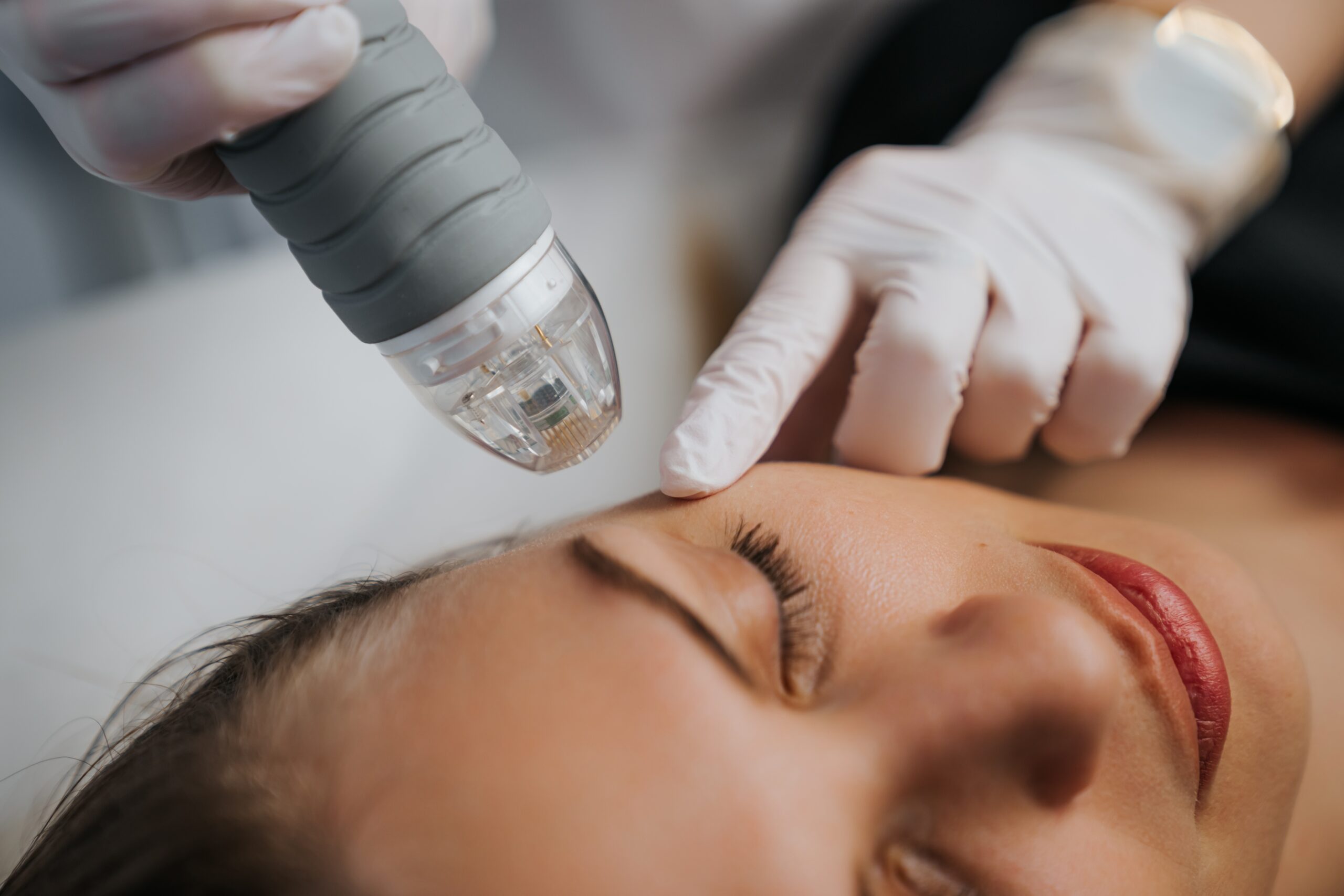 Comparing Laser Treatments: Which is Right for Me?