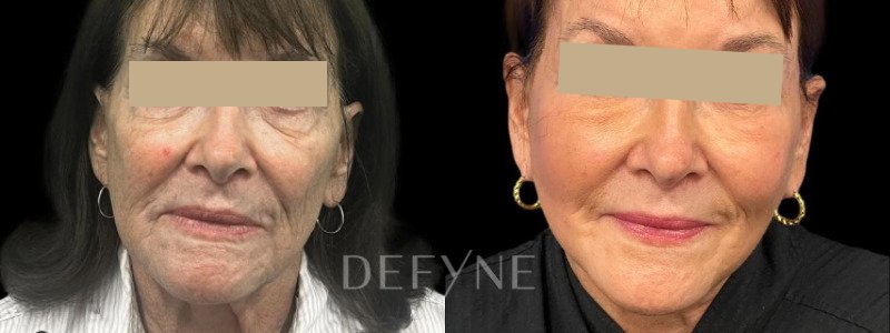 Patient #101579 Combined Image