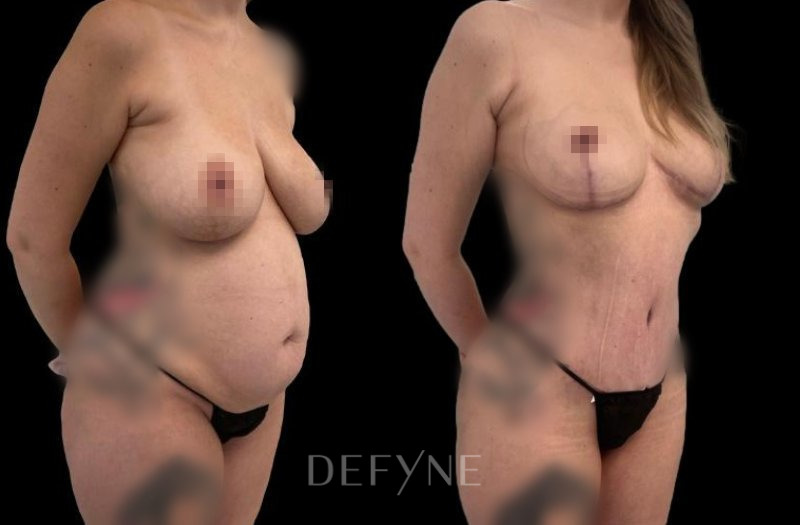 Patient #40102 Combined Image