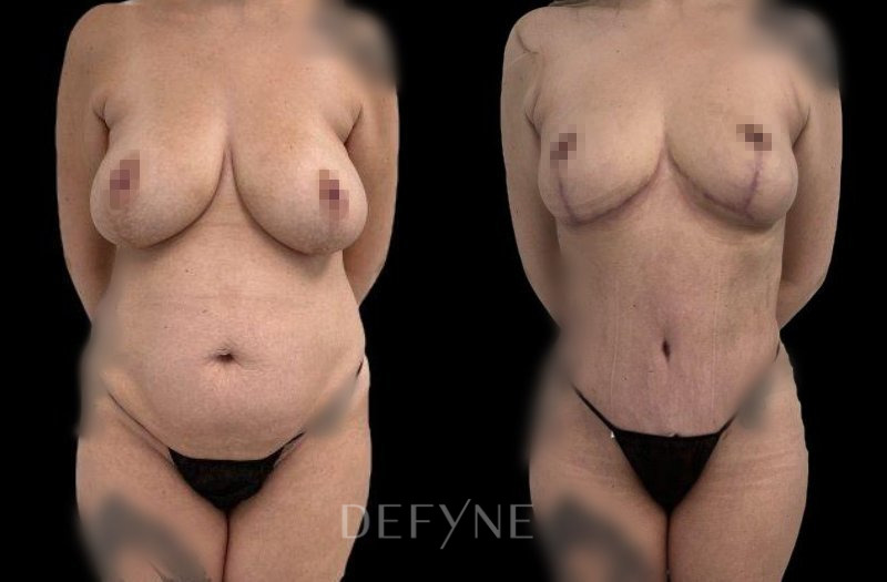 Patient #40102 Combined Image