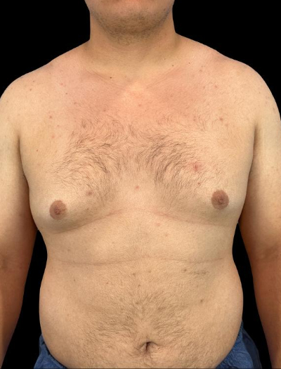 Before — S.M.A.R.T. Core Contour, Patient #41431