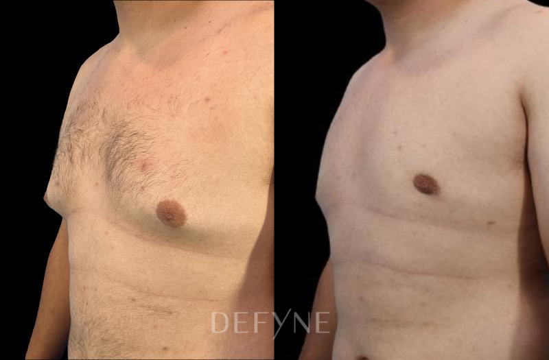 Patient #41431 Combined Image