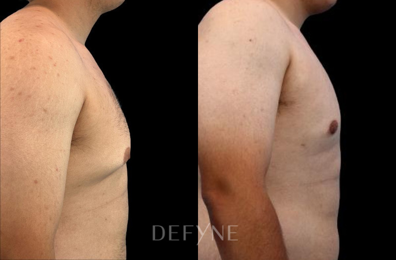 Patient #41431 Combined Image