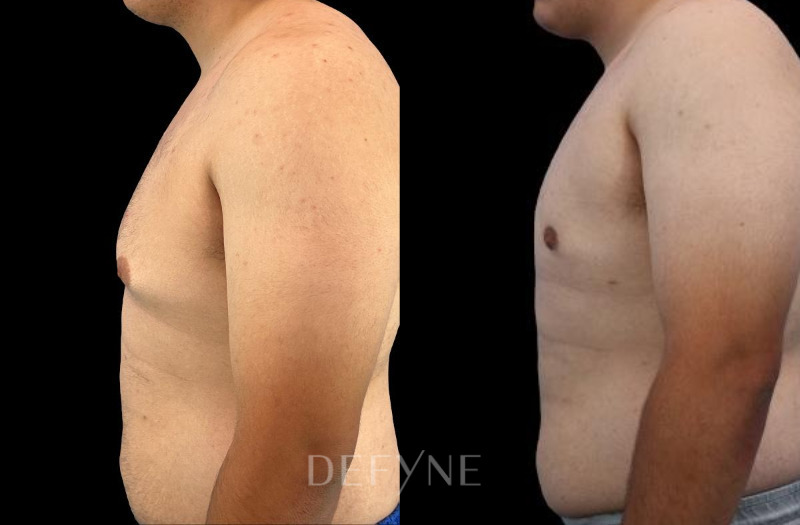 Patient #41431 Combined Image