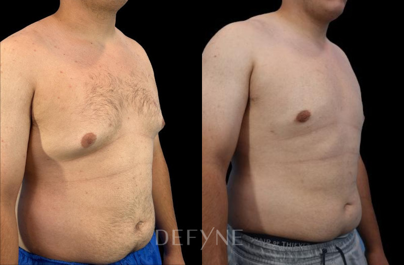 Patient #41431 Combined Image