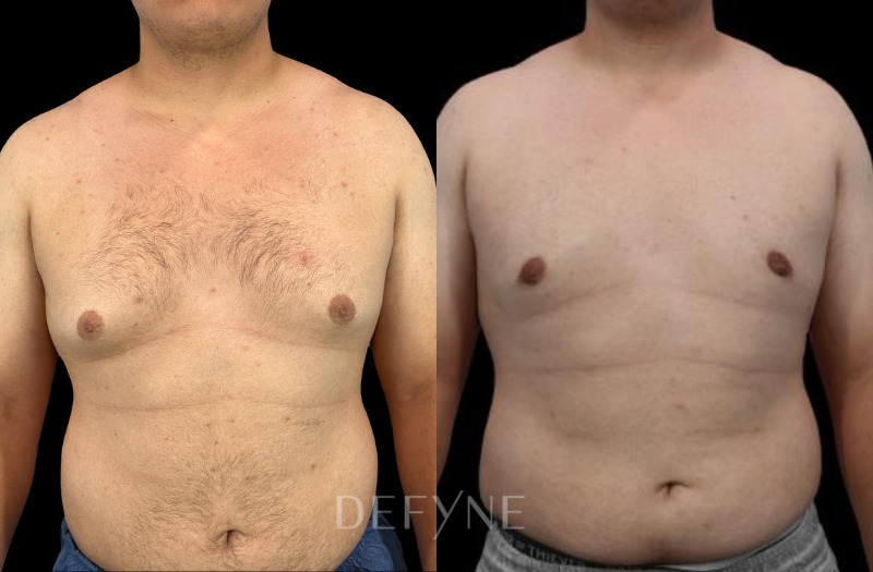 Patient #41431 Combined Image