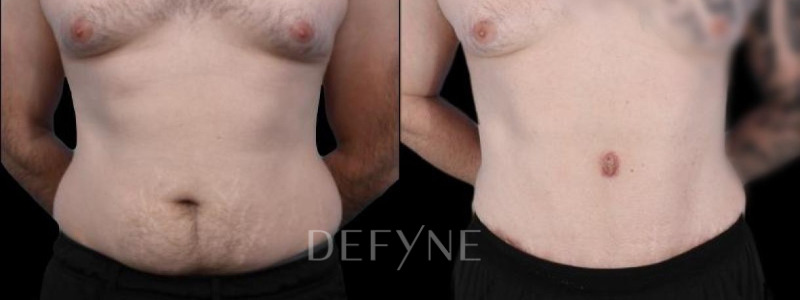 Patient #94281 Combined Image