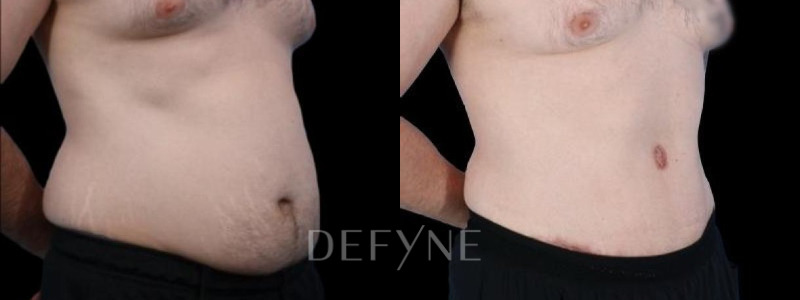 Patient #94281 Combined Image