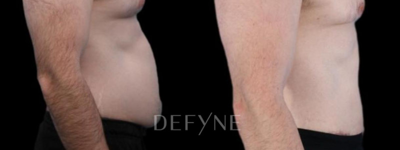 Patient #94281 Combined Image