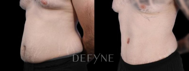 Patient #94281 Combined Image