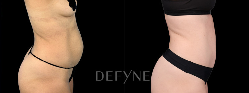 Patient #8557 Combined Image