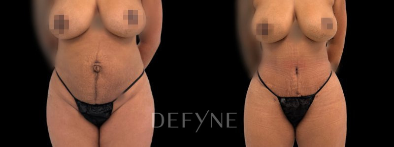 Patient 10307 Combined Image