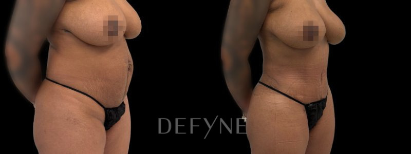 Patient 10307 Combined Image