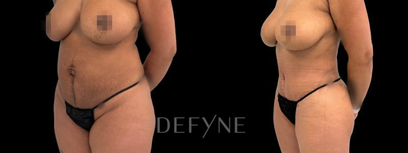 Patient 10307 Combined Image