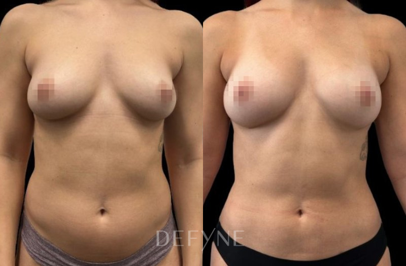 Patient #18395 Combined Image