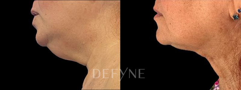 Patient #29875 Combined Image