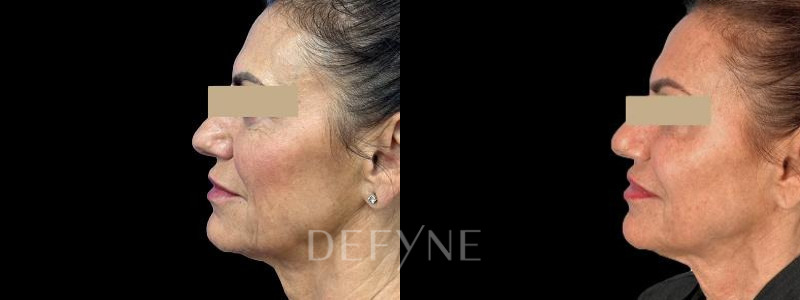 Patient #33471 Combined Image