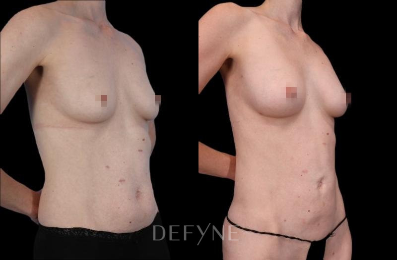 Patient #82001 Combined Image