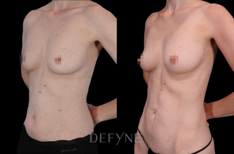 Patient #82001 Combined Image