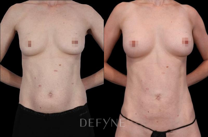 Patient #82001 Combined Image