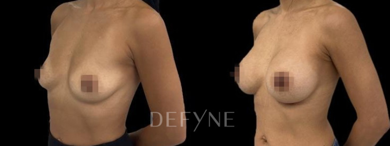 Patient #104376 Combined Image