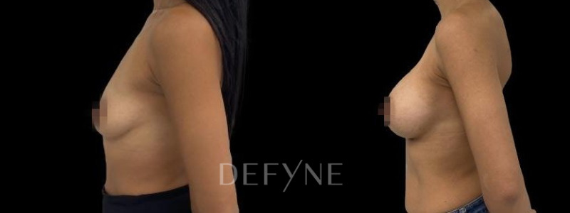 Patient #104376 Combined Image