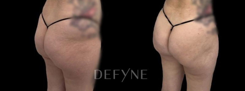 Patient #26436 Combined Image