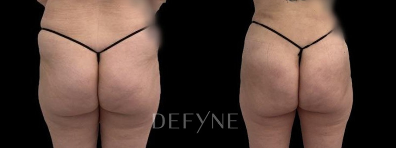 Patient #26436 Combined Image